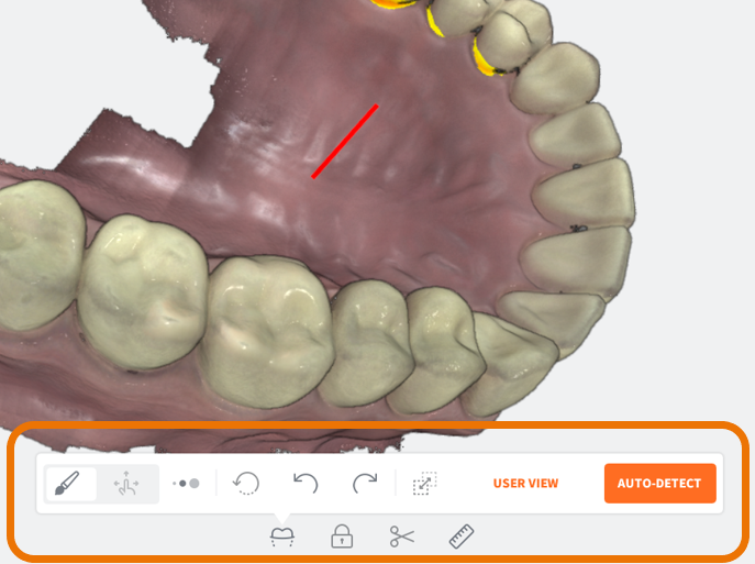 Scan Tools Interface - Undercuts Tool